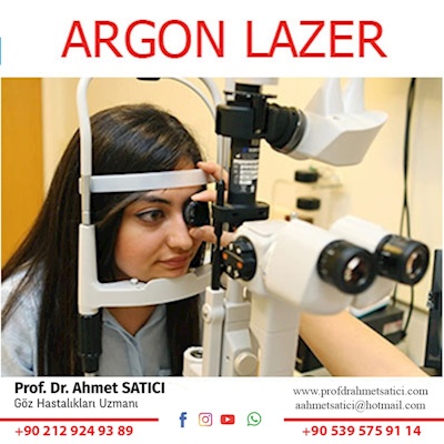 Argon Lazer