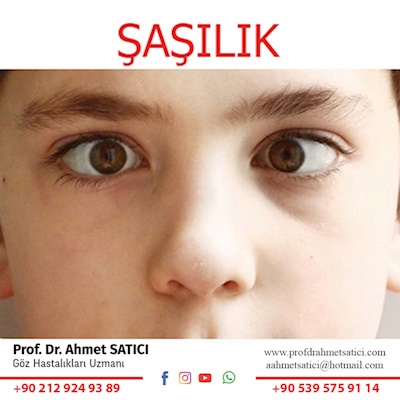Şaşılık (Göz Kayması)