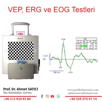 ERG VEP Testi