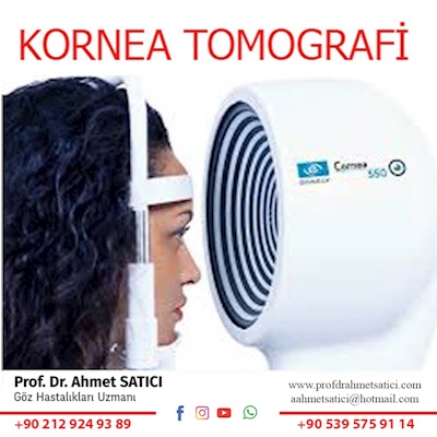 Kornea Topografisi