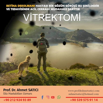 Vitrektomi